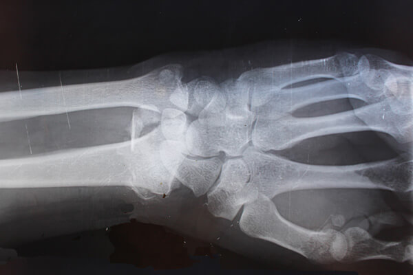 Medical Malpractice Case